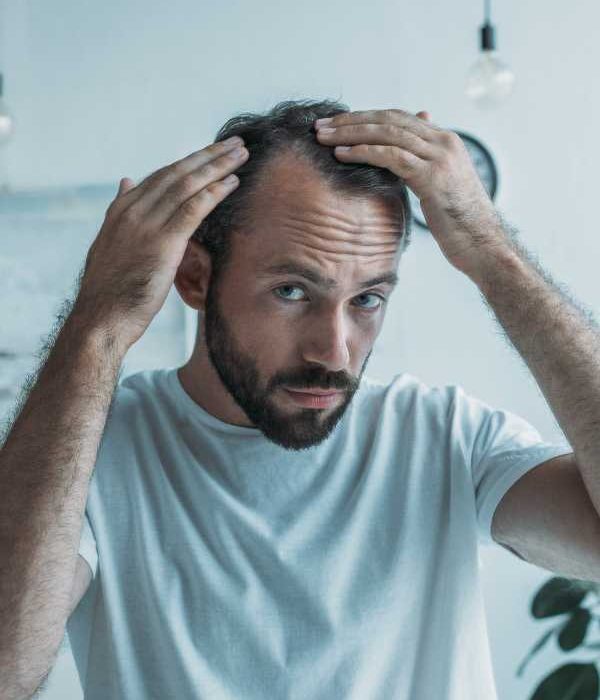 beneficios tratamiento capilar hombre